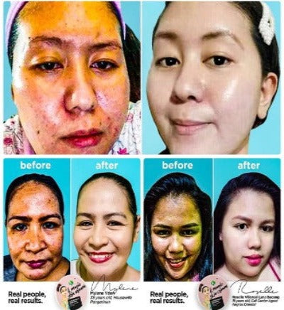 This is a K Magic Multi-Functional Facial Skin Cream ( NOW in 2 sizes: 15 gms or 50 gms. )